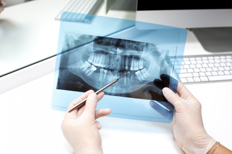 Dental X rays