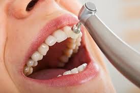 Teeth c Teeth cleaning