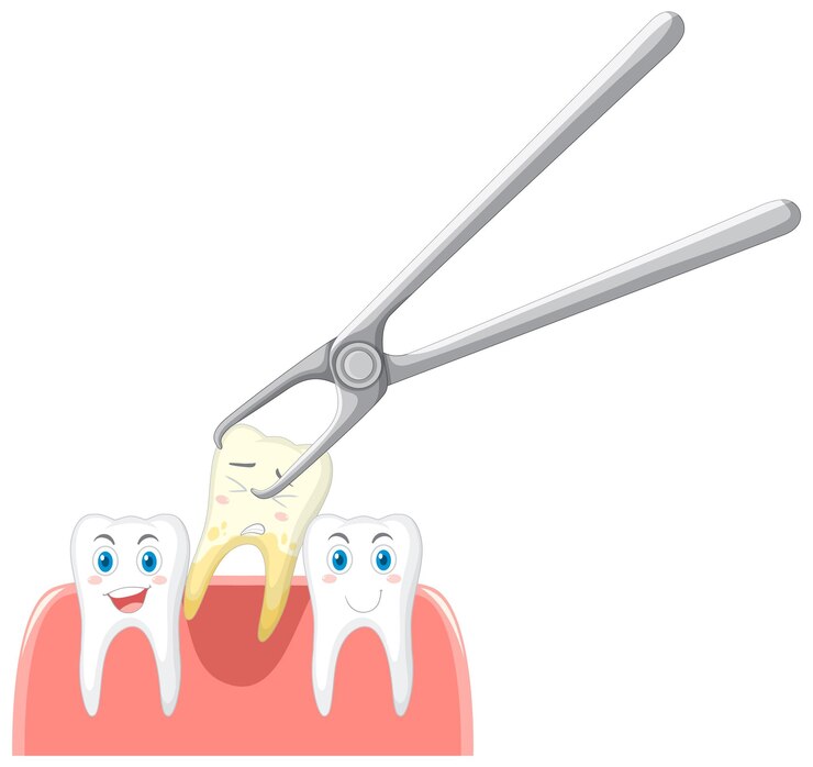 Tooth extractions Tooth extractions